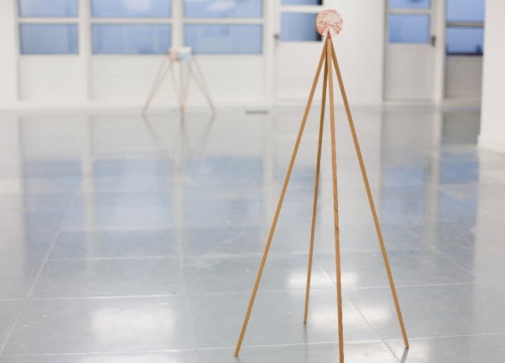 The Wolfson Syndrome exhibition view